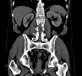 rmn pelvis abdomen