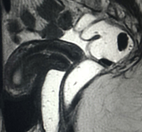 rmn pelvis