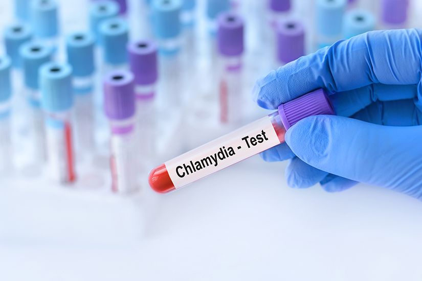 chlamydia