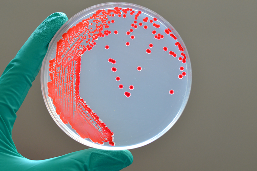 Infectia cu Serratia marcescens