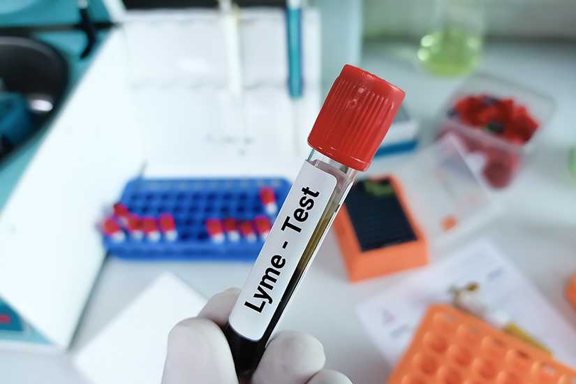 diagnosticare boala lyme