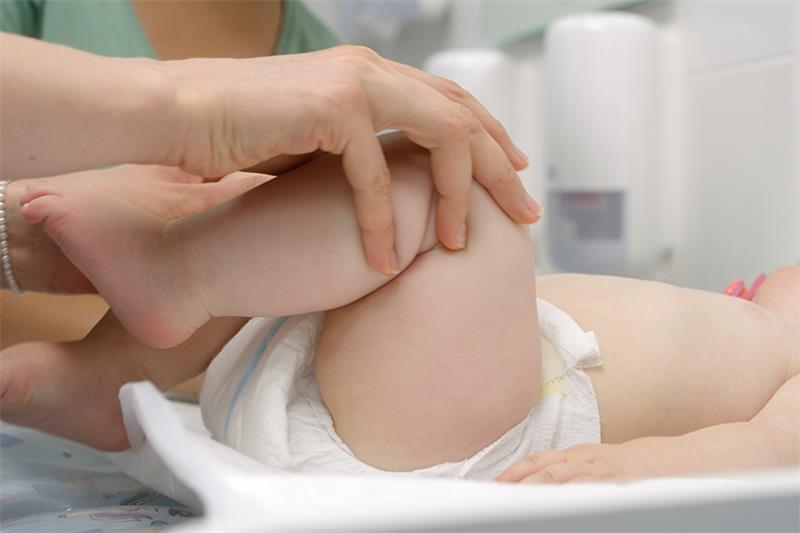 displazie sold bebelusi simptome