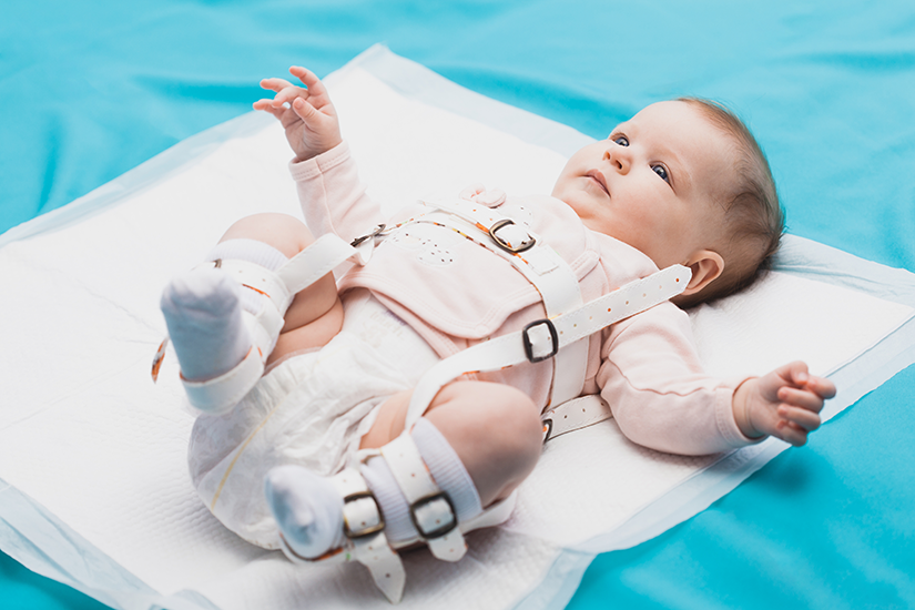 displazie sold bebelusi tratament