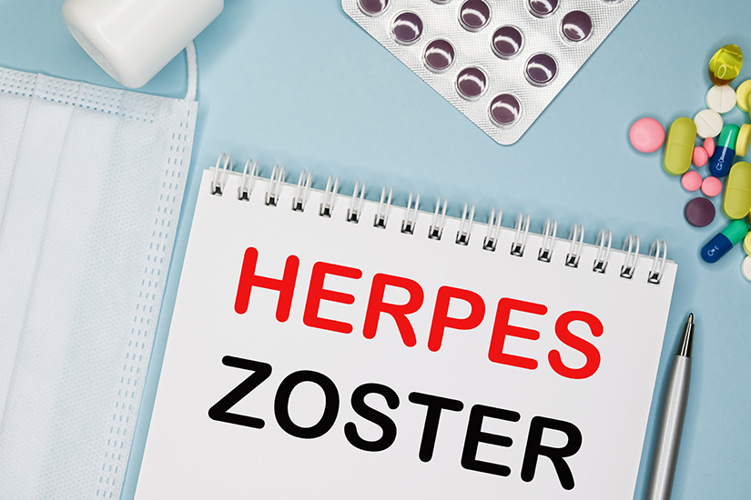zona zoster tratament antiviral