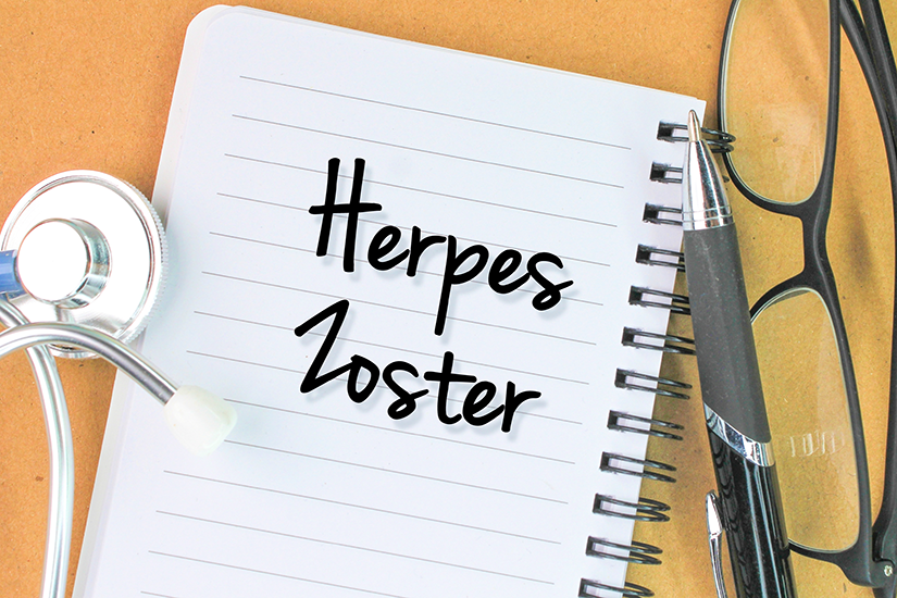 zona zoster