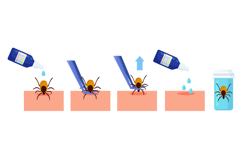 pasi scoatere capusa