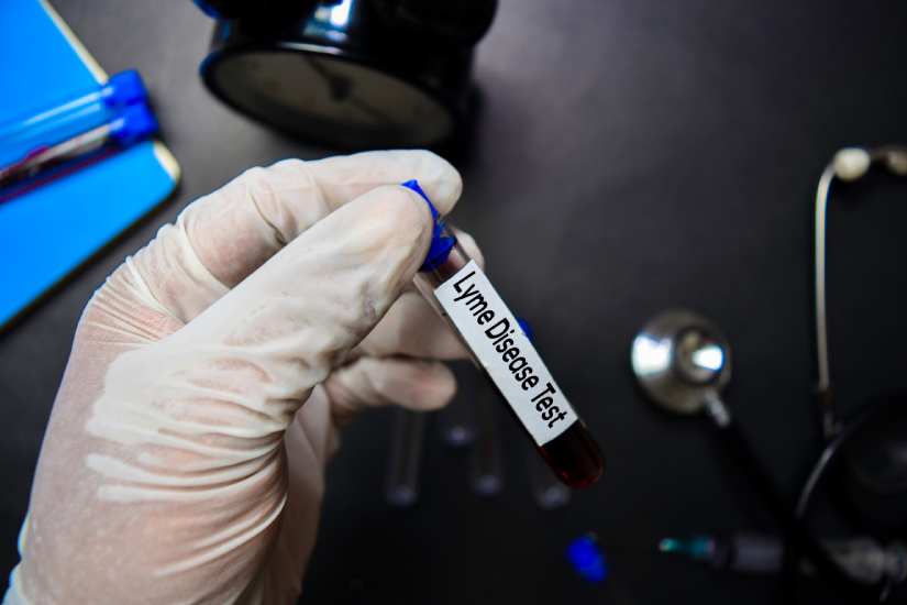 test boala lyme
