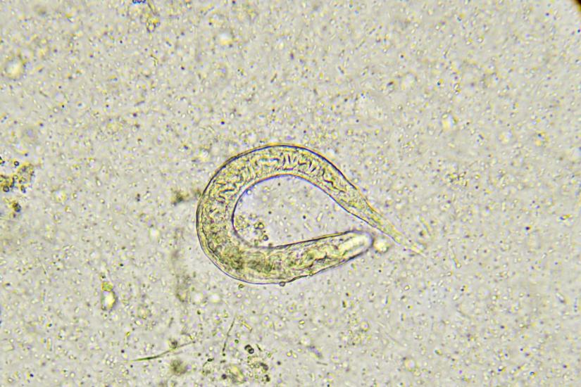 Strongyloides stercoralis