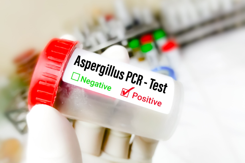 test-pozitiv-aspergillus