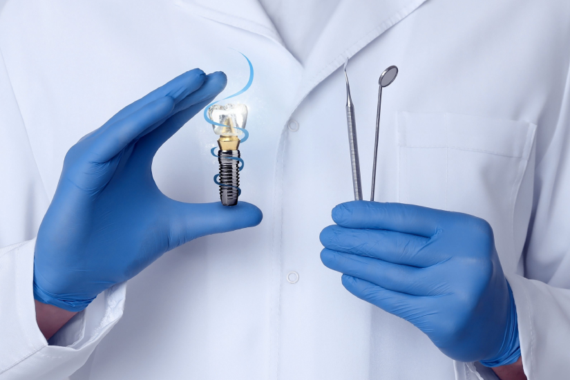 Avantaje implanturi Straumann BLX