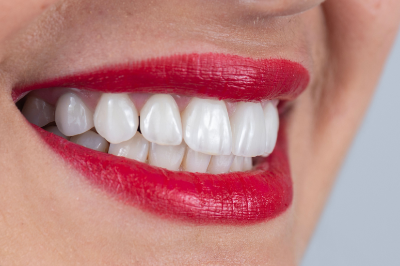 Componente protetice cu aspect natural