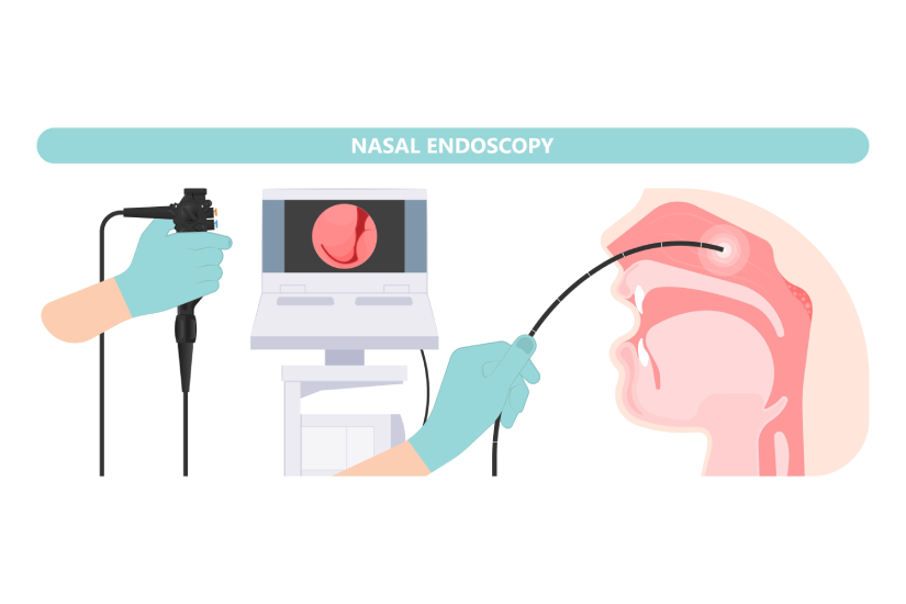 Endoscopie nazală