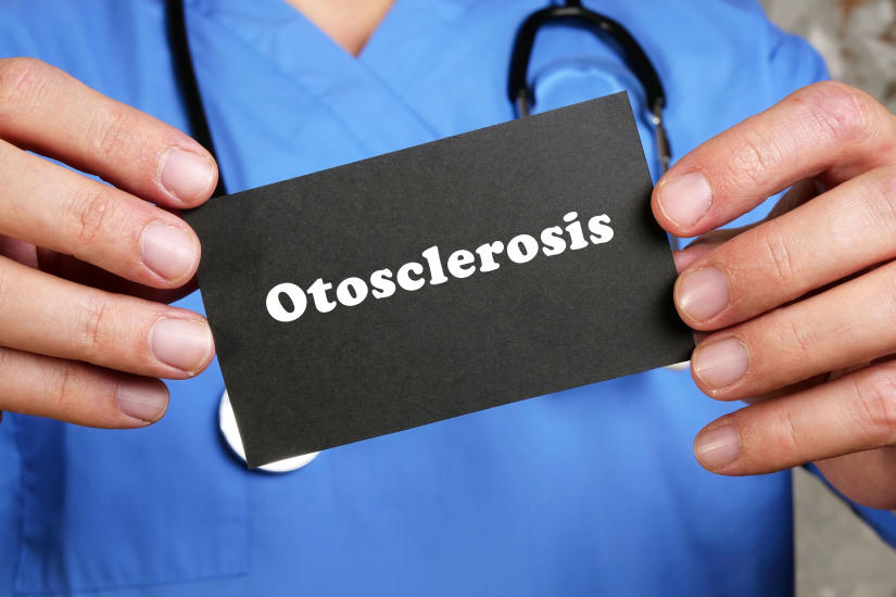 Otoscleroza