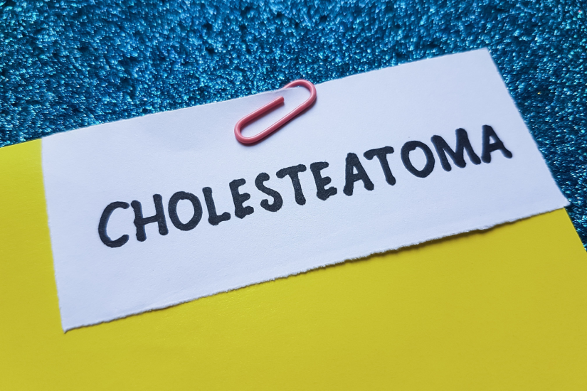 Timpanul perforat netratat poate duce la colesteatom