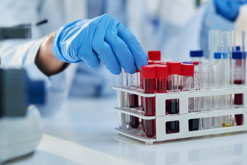 Analize de sânge