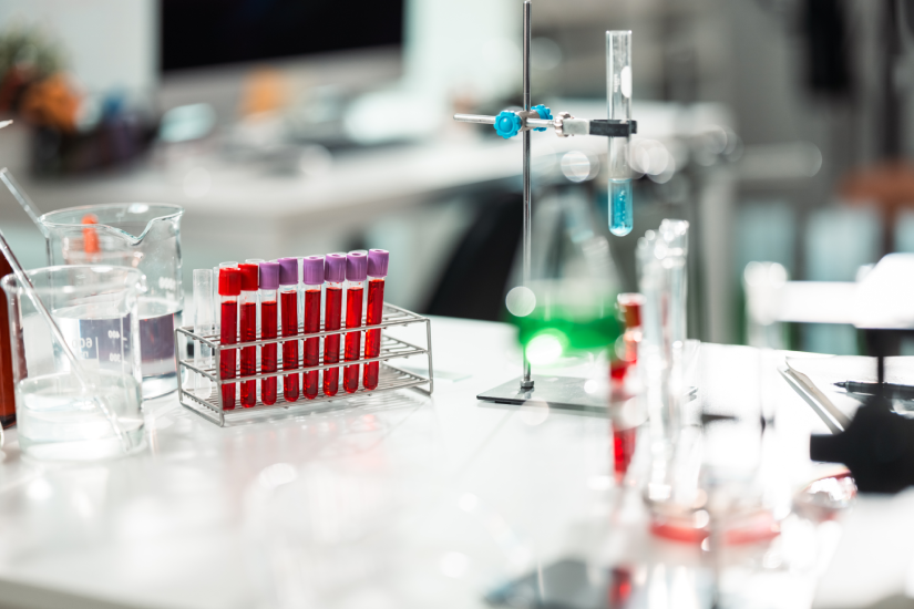 Analize de sânge în laborator