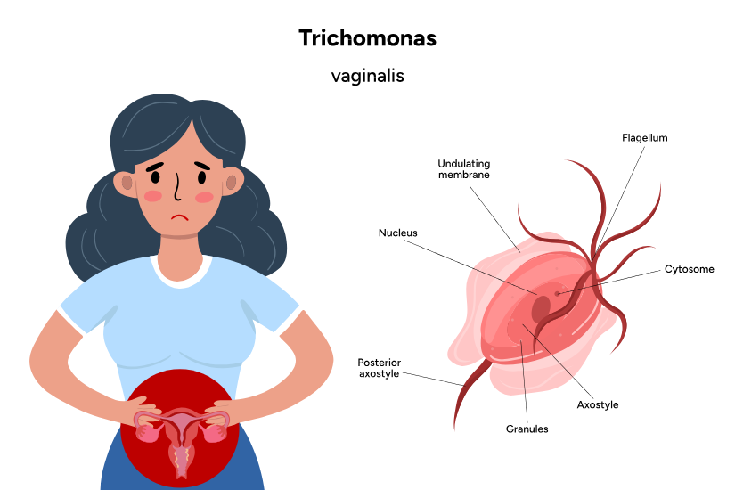 Parazitul Trichomonas vaginalis
