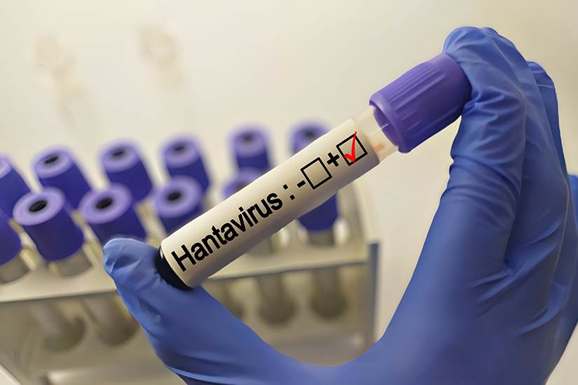 hantavirus