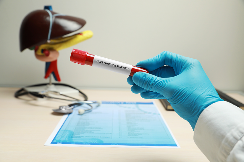 Analize de sânge pentru ciroza hepatică