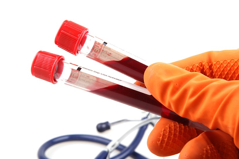 Analize de sânge pentru un diagnostic corect