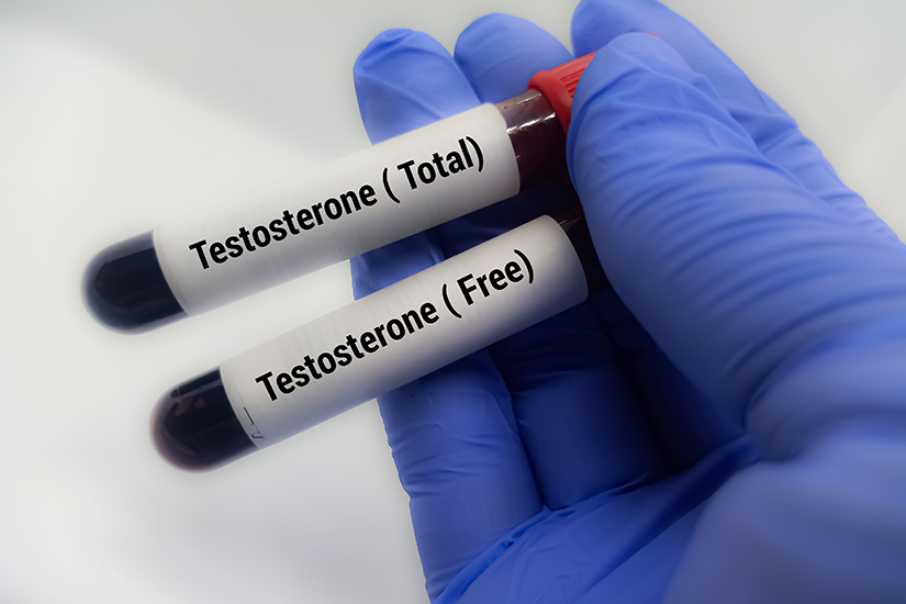 analize-testosteron
