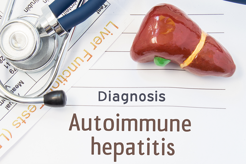 Diagnosticul hepatitei autoimune se face prin analize de laborator