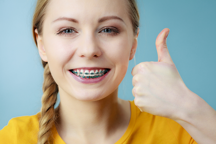 purtare-aparat-dentar-fara-disconfort