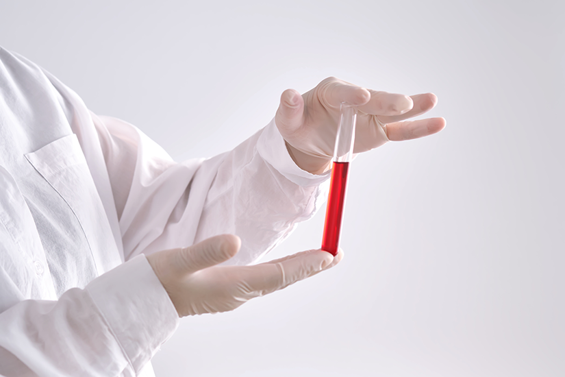 Analize pentru diagnostic oncologic