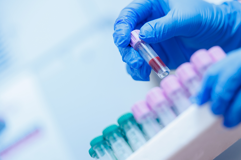 Analize care completează testul genetic