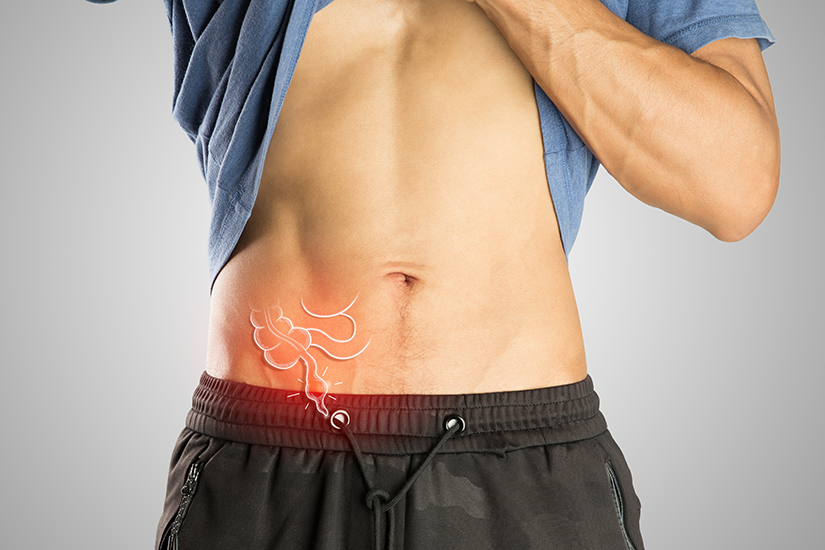 locatie-apendice-inflamat
