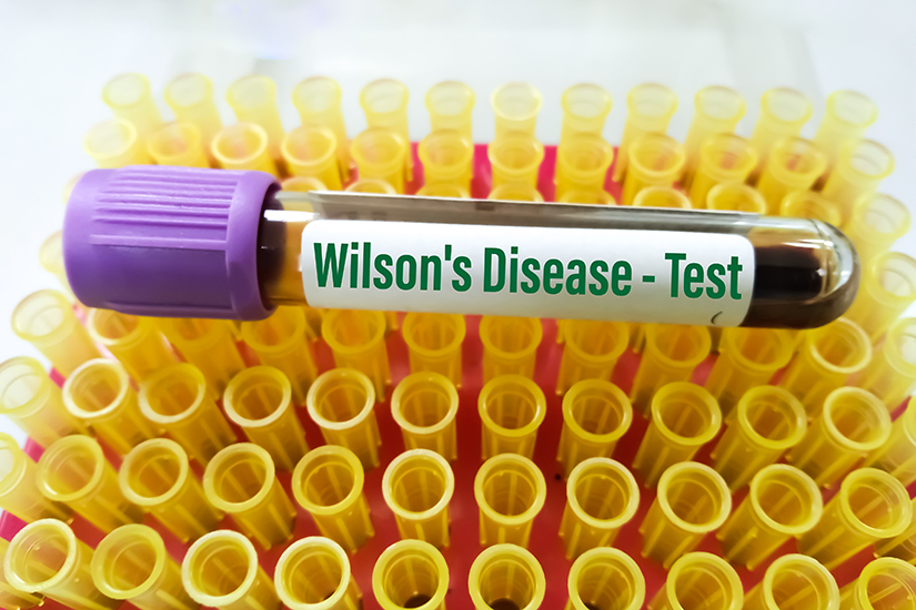 test-boala-wilson