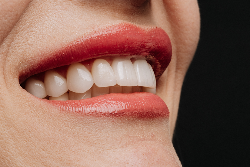  Implant dentar premium