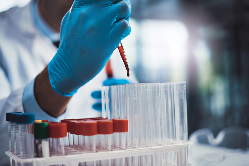 Test molecular modern