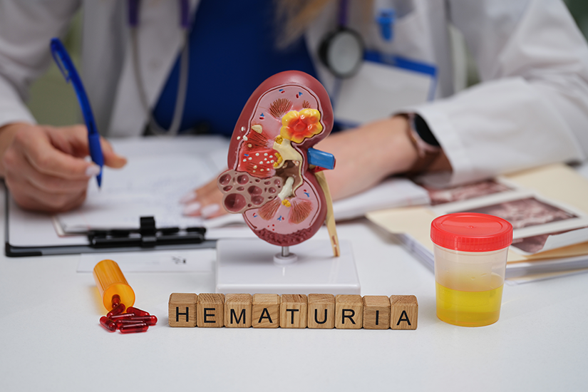 Hematurie