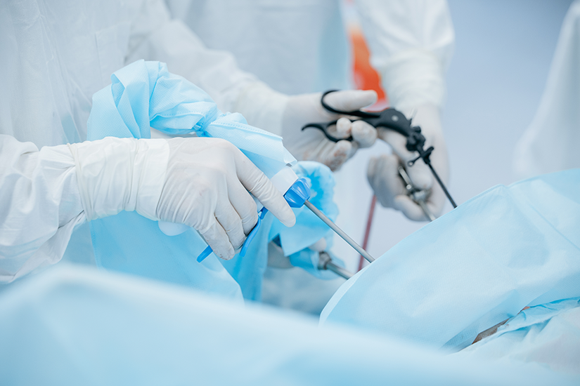 Interventie laparoscopica