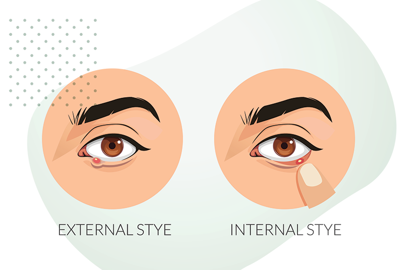 Orjelet intern vs orjelet extern – ilustrație