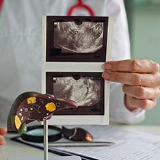 Medic prezentând imagini medicale și un model al ficatului pentru evaluare hepatică