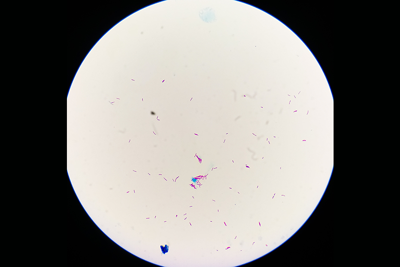 Reprezentare imagistică a bacteriei Mycobacterium tuberculosis