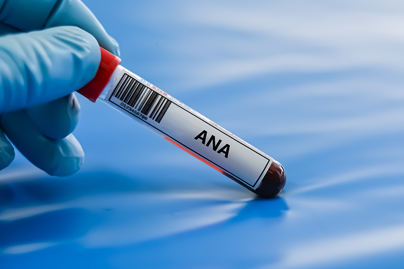 Eprubete pentru analize de imunologie și anticorpi antinucleari ANA