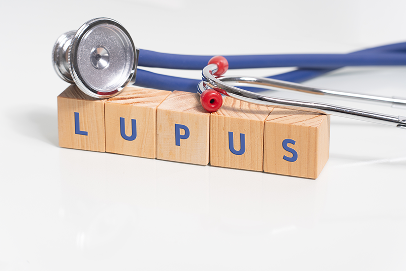 Lupus eritematos sistemic