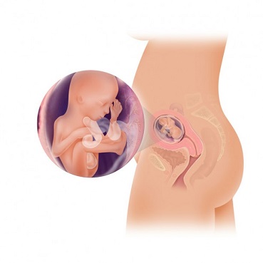Cand se ridica uterul in sarcina