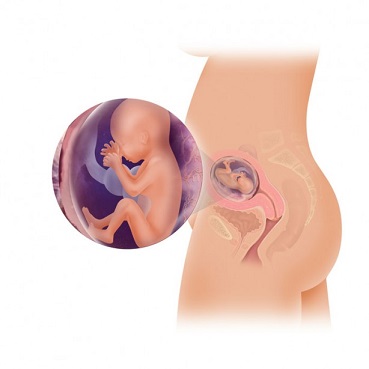 Sec iunea de cautare a femeilor gravide