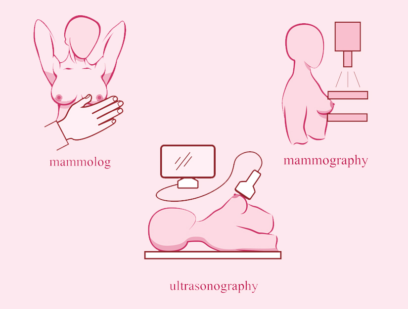 Cancerul de san – depistarea precoce prin screening