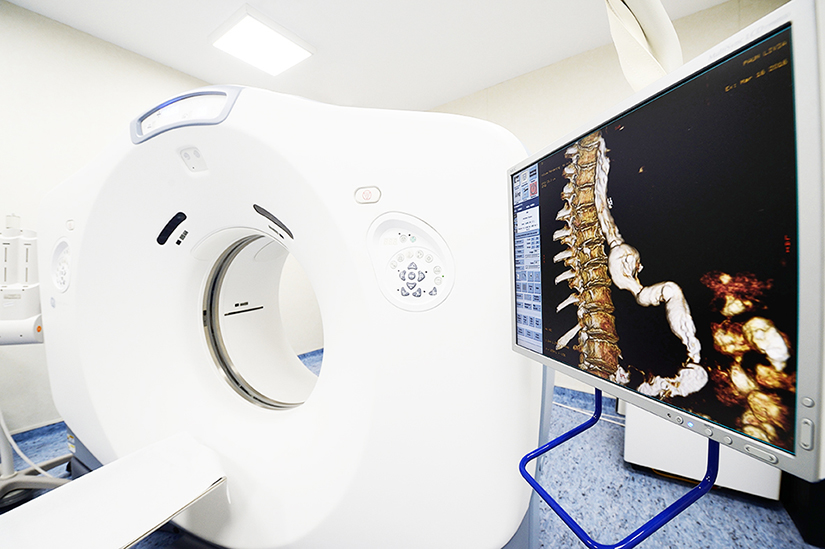 Poate fi redusa expunerea la radiatii X la examenul CT?