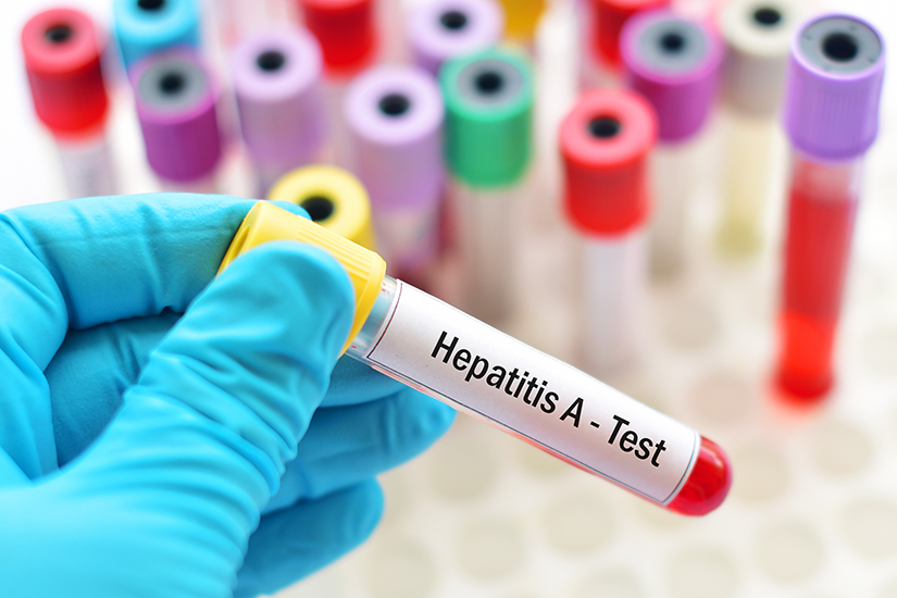 Hepatita A - analize
