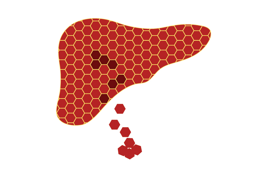 Testele screening pentru hepatita virală B si C