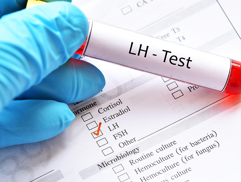 Profilul hormonal: Hormonul luteinizant (LH)
