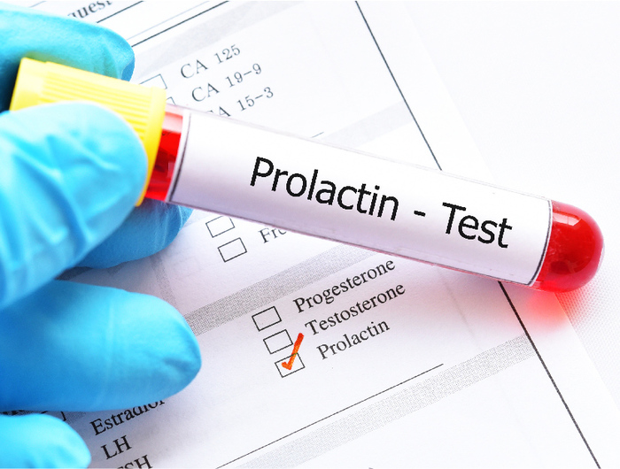 Profilul hormonal: prolactina