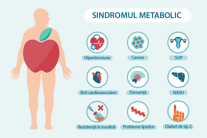 sindromul metabolic provoacă pierderea în greutate