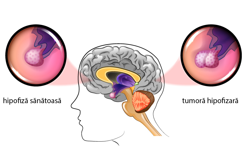 Exemple de patologie a vederii, Patologia de masă a organelor vorbirii și vederii auzului